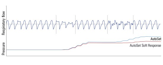 airsense-autoset-soft-response-algorithm-resmed