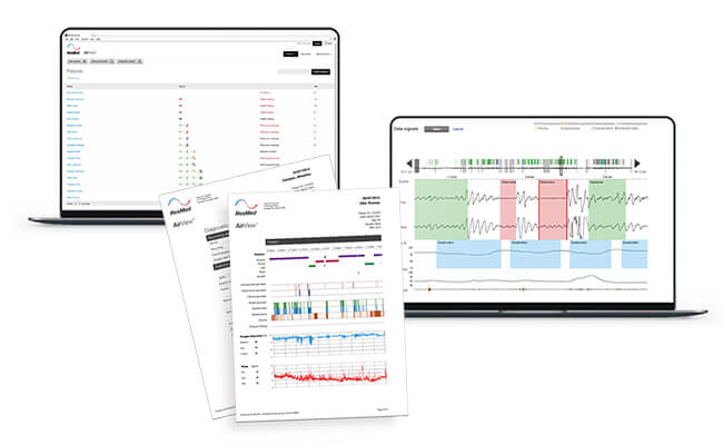 Examples of ApneaLink Air reports in AirView, shown on two computer screens and as print-outs.