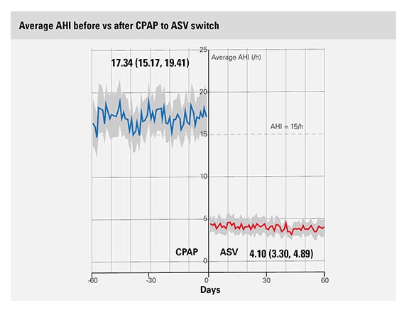 big-data-ASV-switch-AHI-ResMed