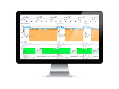 noxturnal-signal-sheet-resmed