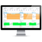 noxturnal-software-signal-sheet-resmed