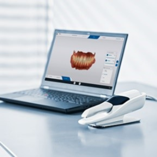Image of an intra-oral scan on a computer screen, next to the scanner on a desk